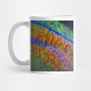 Brain cells, fluorescence micrograph (C023/4113) Mug